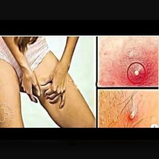 HT10. These are the signs that he is cr… See more s3